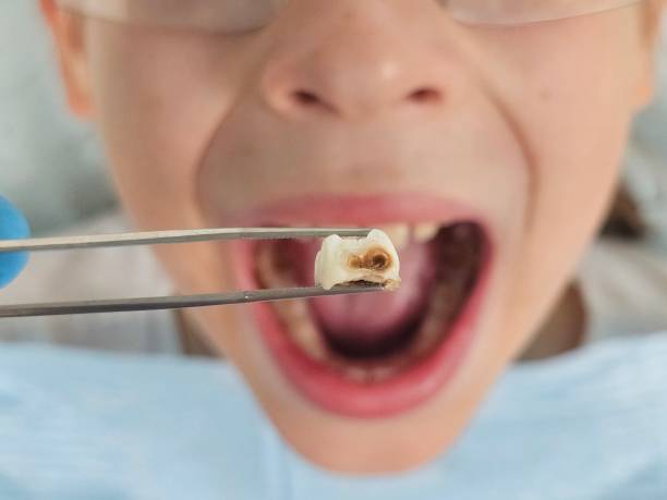 Best Same-Day Emergency Dental Services in Cannon Af, NM
